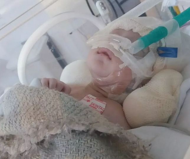 Bebê luta pela vida em hospital de Ermelino